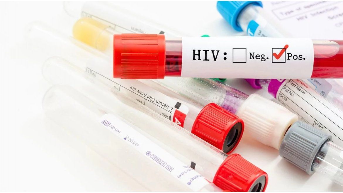 Todo Jujuy | HIV en Argentina