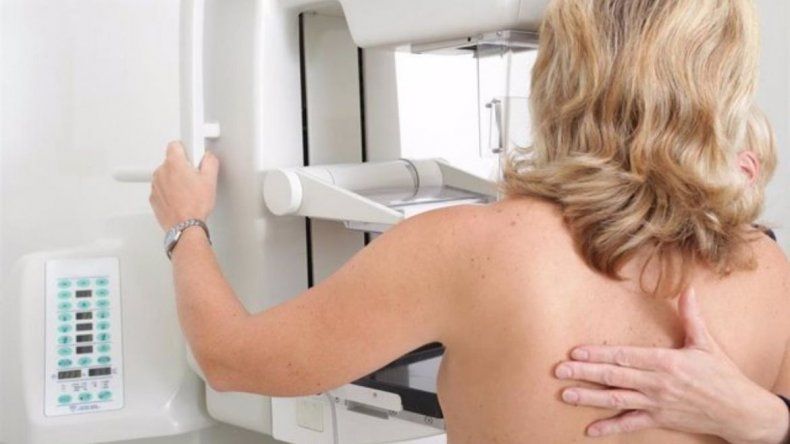 Mamograf&iacute;a. El estudio m&eacute;dico es fundamental para detectar el c&aacute;ncer de mama a tiempo.&nbsp;