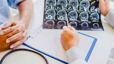 El tumor cerebral puede tratarse en Jujuy. /Imagen ilustrativa