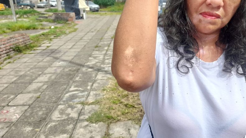 Cristina Sarapura contó que quiso ayudar en un choque con menores involucrados y terminó herida, con visión borrosa y en estudios médicos.