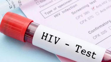 Se registró el tercer caso en el mundo de un paciente que eliminó el VIH de su cuerpo.