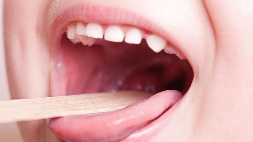 10 víctimas fatales: 3 muertes más por estreptococo 