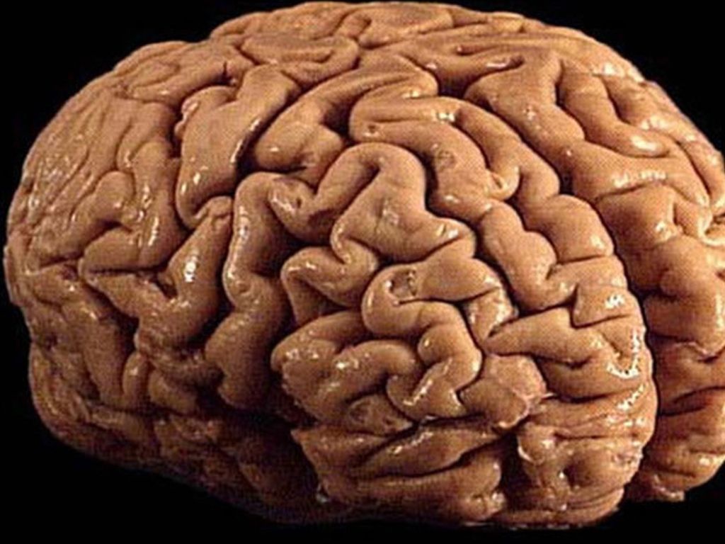 Cerebro