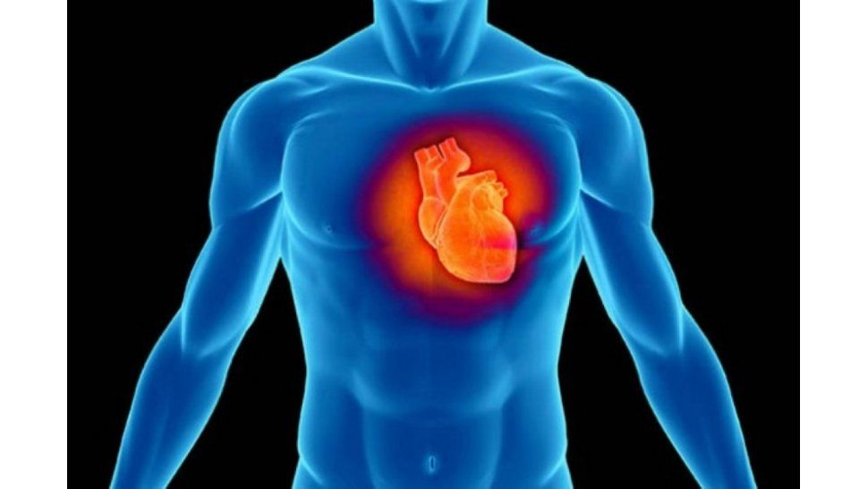 Reemplazar el marcapaso