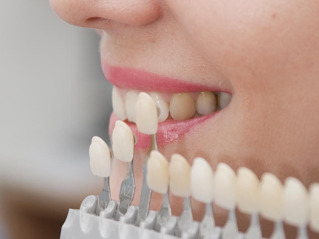 Piezas dentales