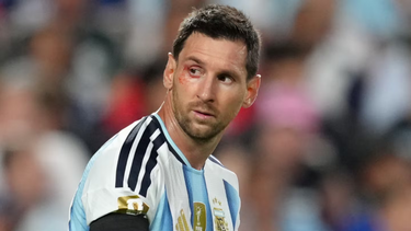 que le paso a lionel messi en el ojo: el golpe que le provoco un corte y sangre en el rostro