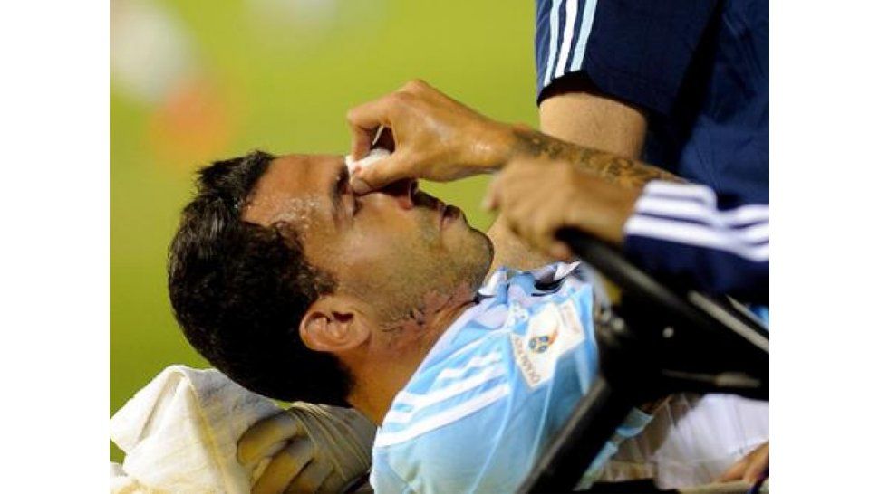 Tevez lesionado