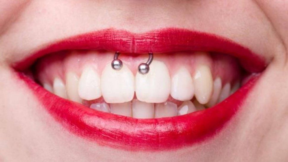 Enfermedad silenciosa: especialistas alertan por los piercings en la boca