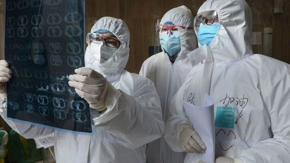 M&eacute;dicos examinan los estudios pulmonares de un paciente con coronavirus.