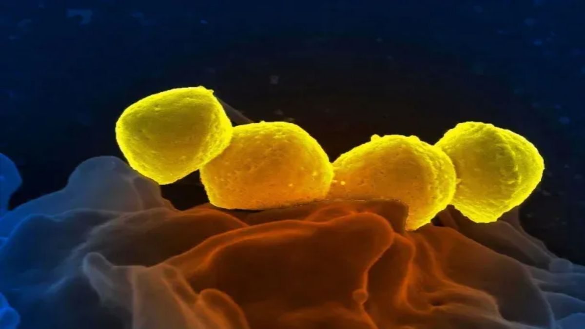Los casos de Streptococcus Pyogenes aumentaron considerablemente desde el último reporte.