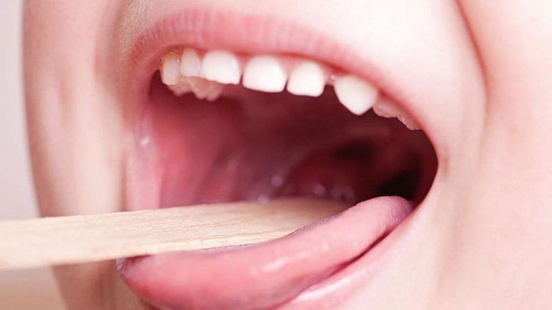 En Jujuy no se detectaron casos de Estreptococo pero instan a tomar medidas preventivas