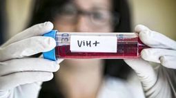 La variante bautizada VB es particularmente agresiva y triplica o incluso quintuplica la cantidad habitual de virus en la sangre.