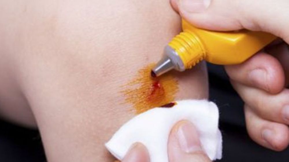 La ANMAT prohibió la comercialización de un producto médico