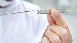 El sistema de salud de Jujuy colocará stents de forma gratuita.