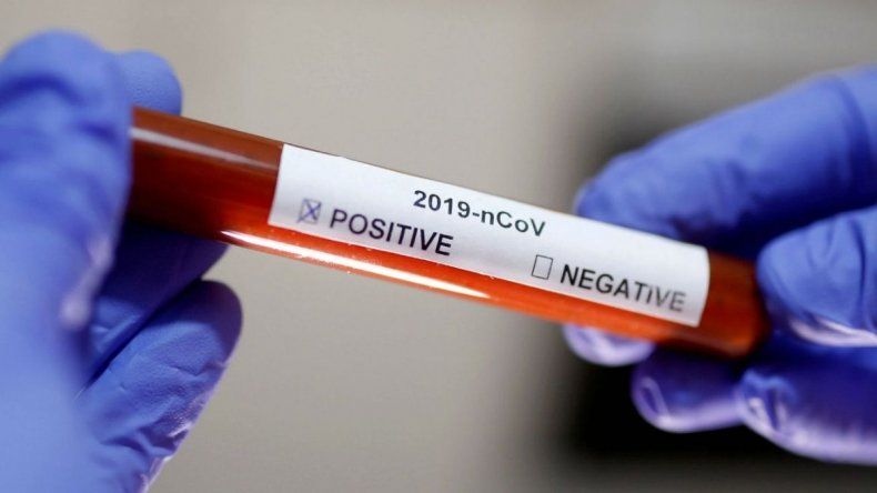 Test de coronavirus. Imagen ilustrativa.