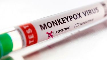 La OMS informó que otros países posiblemente identifiquen más casos de la viruela del mono y que habrá una mayor expansión del virus.