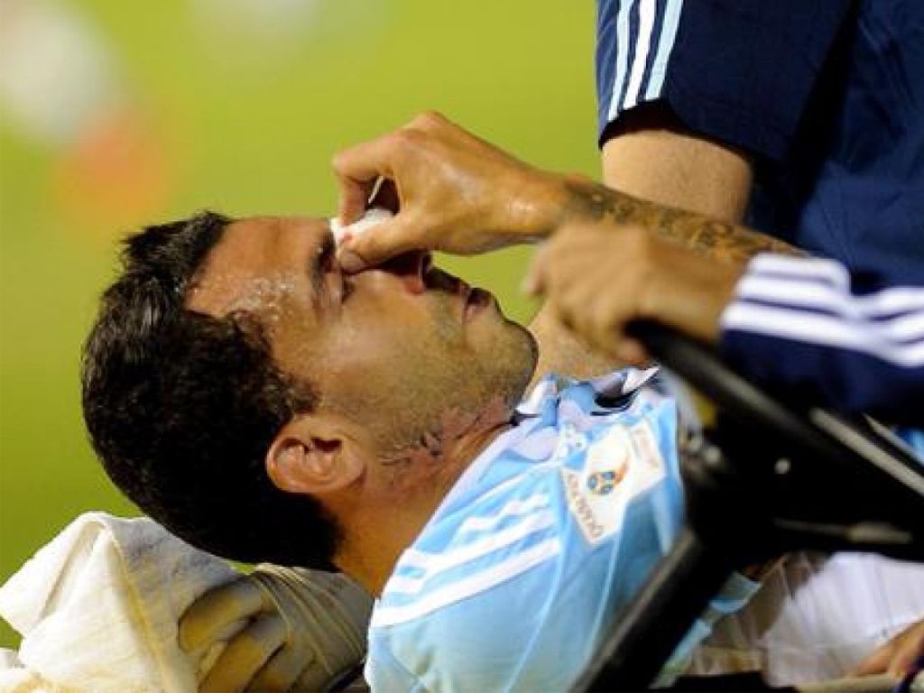 Tevez lesionado