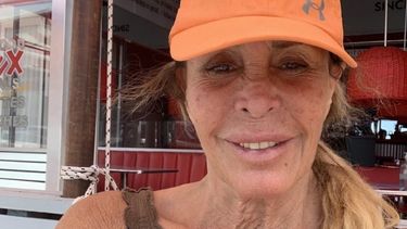 Pata Villanueva se encuentra en estado crítico.&nbsp;