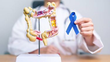 Por año se detectan 15.000 nuevos casos de cáncer de colon en Argentina Por año se detectan 15.000 nuevos casos de cáncer de colon en Argentina