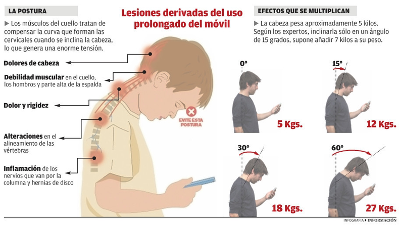 El uso de teléfonos celulares y tablets aumenta las lesiones cervicales y en niños puede derivar en alteraciones en la columna y dolencias como las hernias