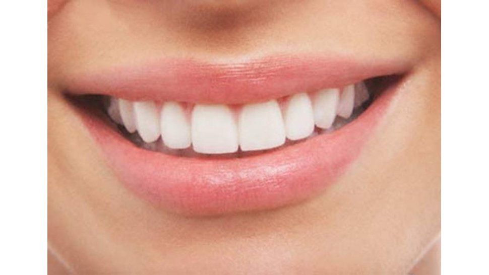 Sonrisa sólo saludable