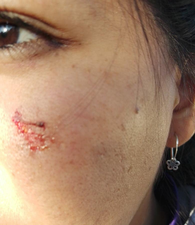 Perico. Mujer sufrió golpes de la agresora que quiso arrebatarle a su bebé