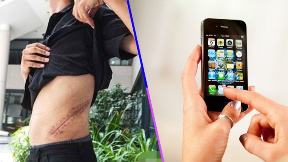 Vendió un riñón en el mercado negro para comprarse un iPhone y quedó discapacitado
