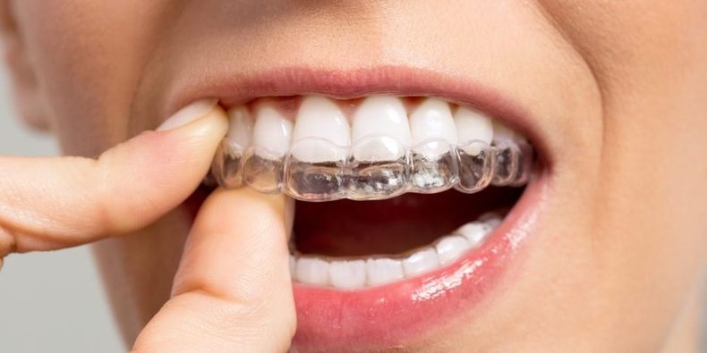 El uso de placas de relajación está cada vez más difundido porque son muchas las personas que por el ritmo de vida actual y debido al estrés, sufren bruxismo que en algunos casos deriva en trastornos de ATM (articulación témporo mandibular).  