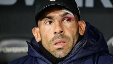 Carlos Tevez sufrió un accidente doméstico