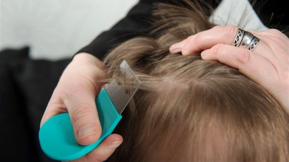 Piojos: ¿Cómo prevenirlos y cuidarlos a nuestros chicos?