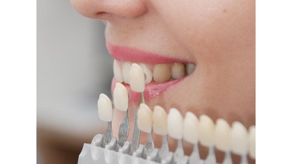 El Carmen: proveerán de prótesis dentales a personas de bajos recursos