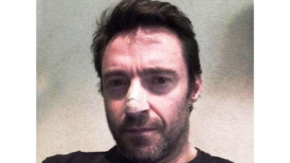 Hugh Jackman