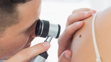 Cada año se diagnostican más de 330.000  nuevos casos de cáncer de piel