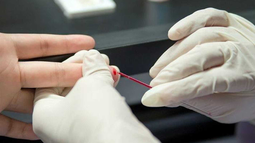 Testeos VIH en Palpalá.