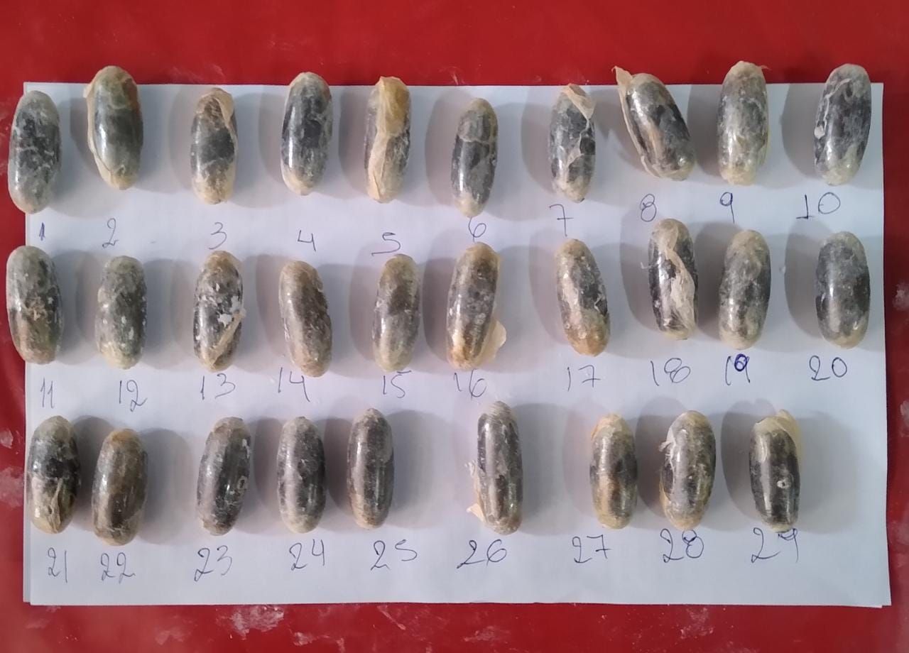 Tenía cápsulas de cocaína en el estómago.