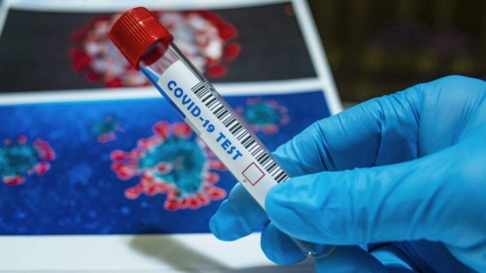 Test coronavirus para detectar nuevos casos