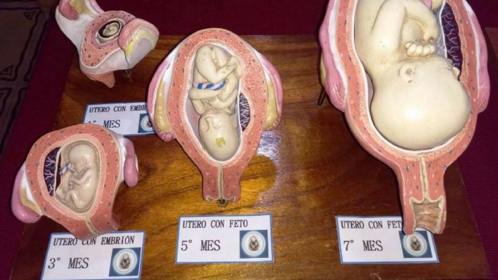 Realizan muestra del Rostro del embrión humano y harán una cadena de oración a favor de la vida