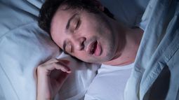 La apnea obstructiva del sueño (AOS) afecta a uno de cada cinco individuos a nivel mundial.