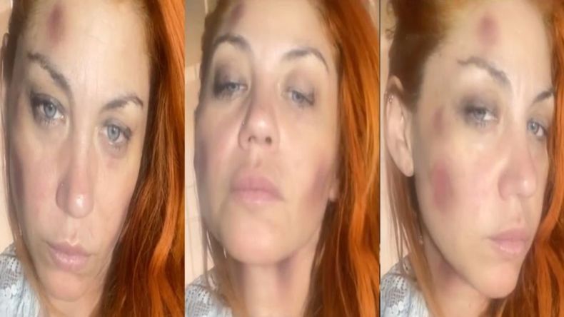 En sus redes sociales, la cantante Lourdes Fernández contó que sufrió violencia de género por parte de su ex pareja.&nbsp;