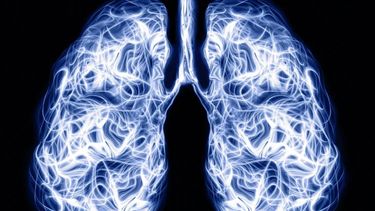 En Argentina se confirman 12.000 casos de cáncer de pulmón al año.