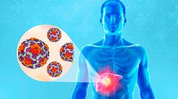 Advierten sobre un fuerte aumento de casos de sarampión, paperas y hepatitis A en Argentina. &nbsp;