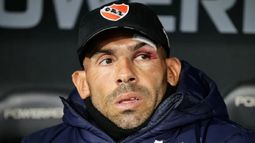 Según se informó, Carlos Tevez estaría afrontando este problema por&nbsp;un “tema de stress”.