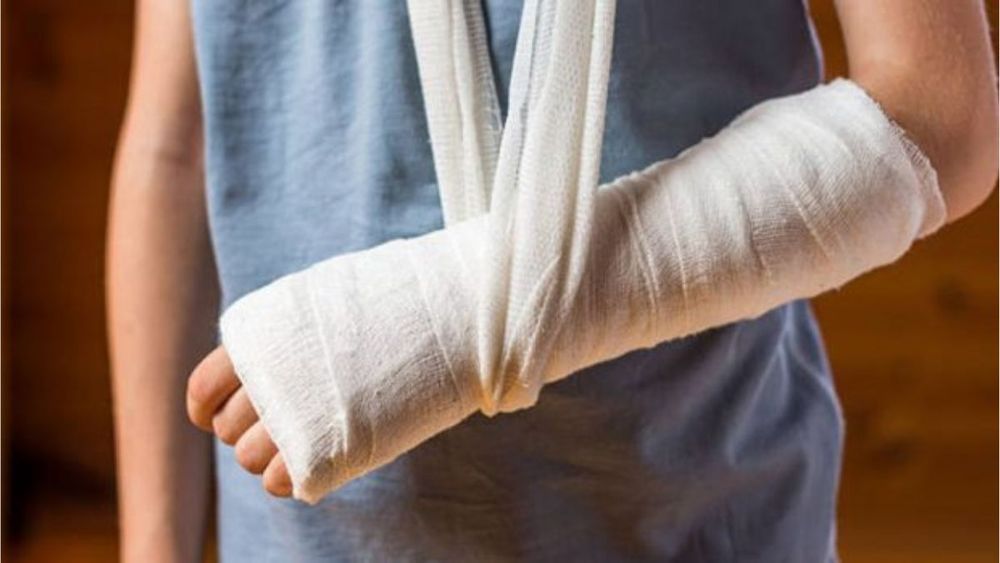 Alta demanda en hospitales de fracturas en niños y niñas por accidentes en épocas de vacaciones.