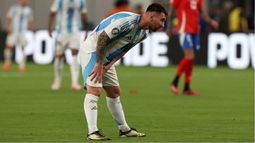 Campos de juego de la Copa América criticados.