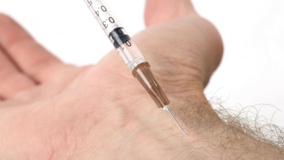 Se inyectó su propio semen durante un año y terminó con el brazo infectado