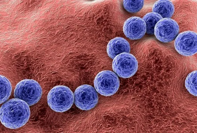 Streptococcus Pyogenes: Los Casos Incrementan Y Ya Hay 93 Muertos