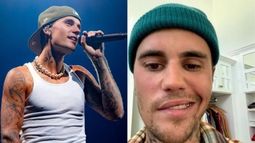 Justin Bieber sufre de un extraño síndrome que le paralizó el rostro.&nbsp;