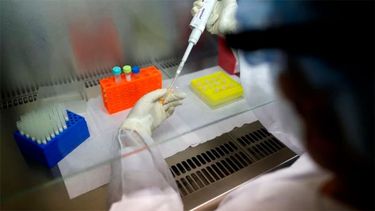 Qué es la Legionella, el brote que estaría detrás de las muertes en Tucumán.&nbsp;