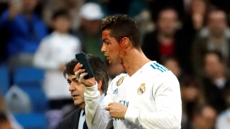 Cristiano sufrió un corte y le pidió el teléfono celular al médico para verse