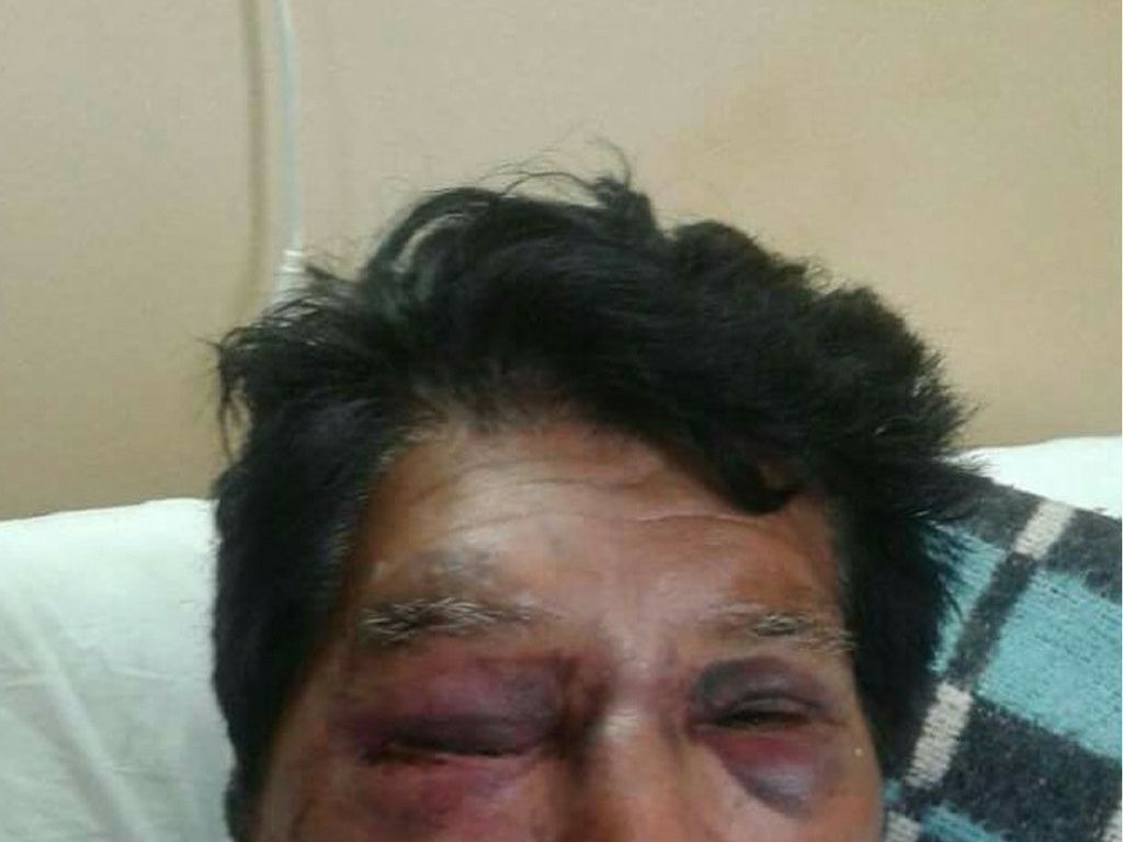 Abuelo golpeado
